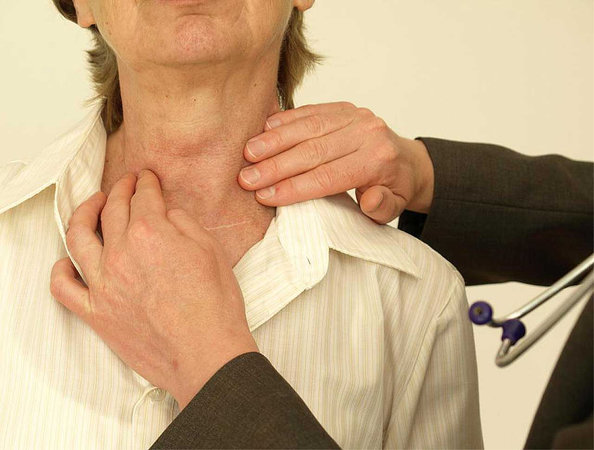 Рак щитовидной железы: очевидные признаки