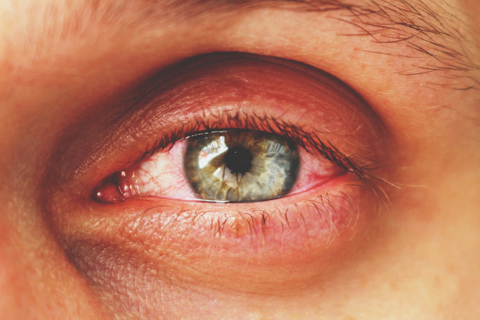 Глаза указывают на болезни в нашем теле