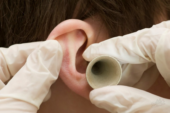 Исследование показало, что вирус SARS-CoV-2 может инфицировать внутреннее ухо