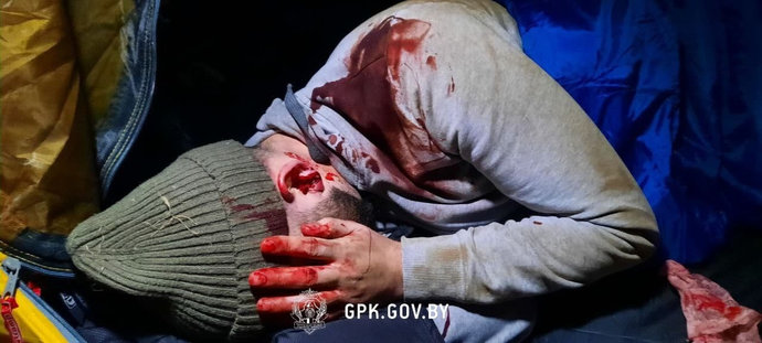 ГПК: на границе обнаружены курдские беженцы, избитые польскими силовиками
