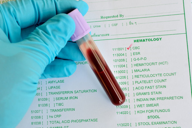 Простой анализ крови может показать эффективность лечения рака
