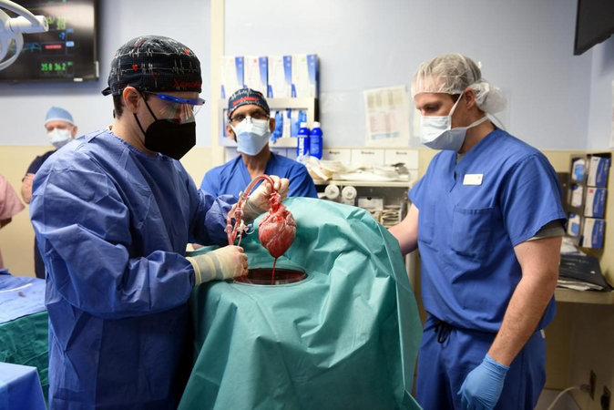 В США сделали первую в мире операцию по пересадке человеку сердца животного