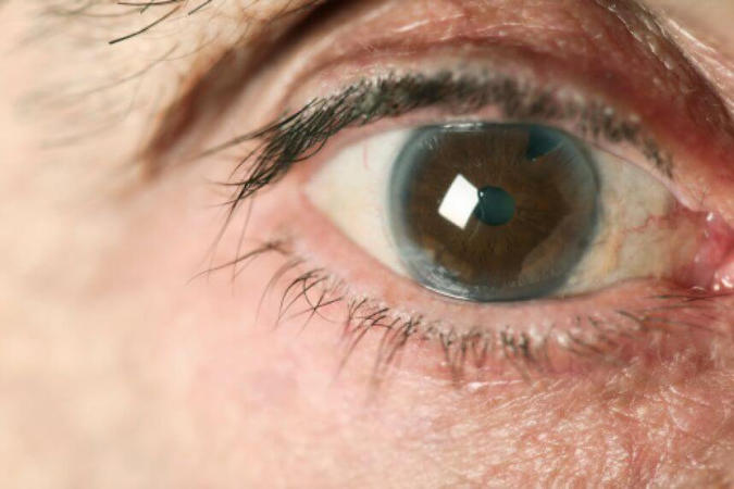 Создан препарат, который защитит от слепоты при глаукоме