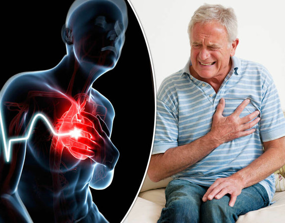 4 главные отличия инфаркта от панической атаки