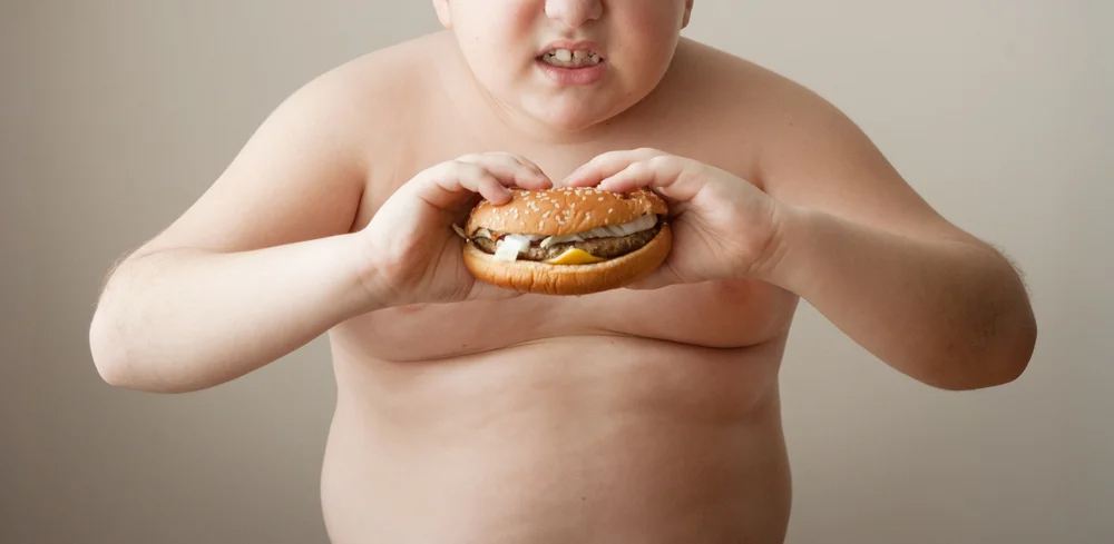 Фото ожирения у детей