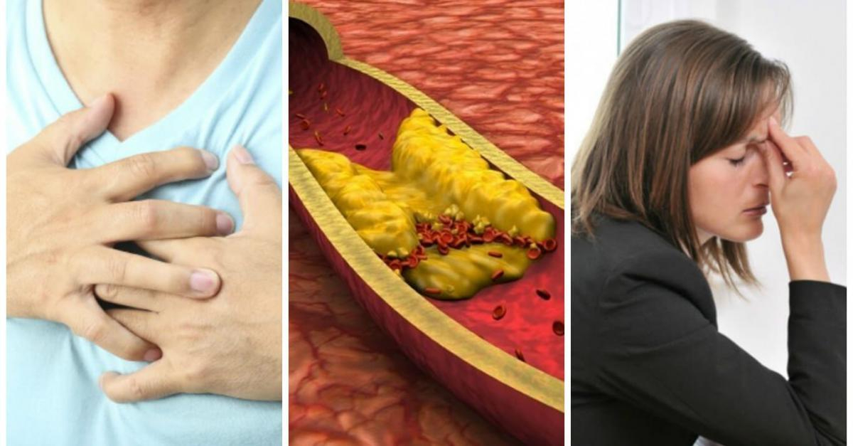 Síntomas de colesterol alto en mujeres de 50 años