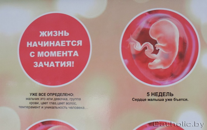 троллейбус с рекламой против абортов