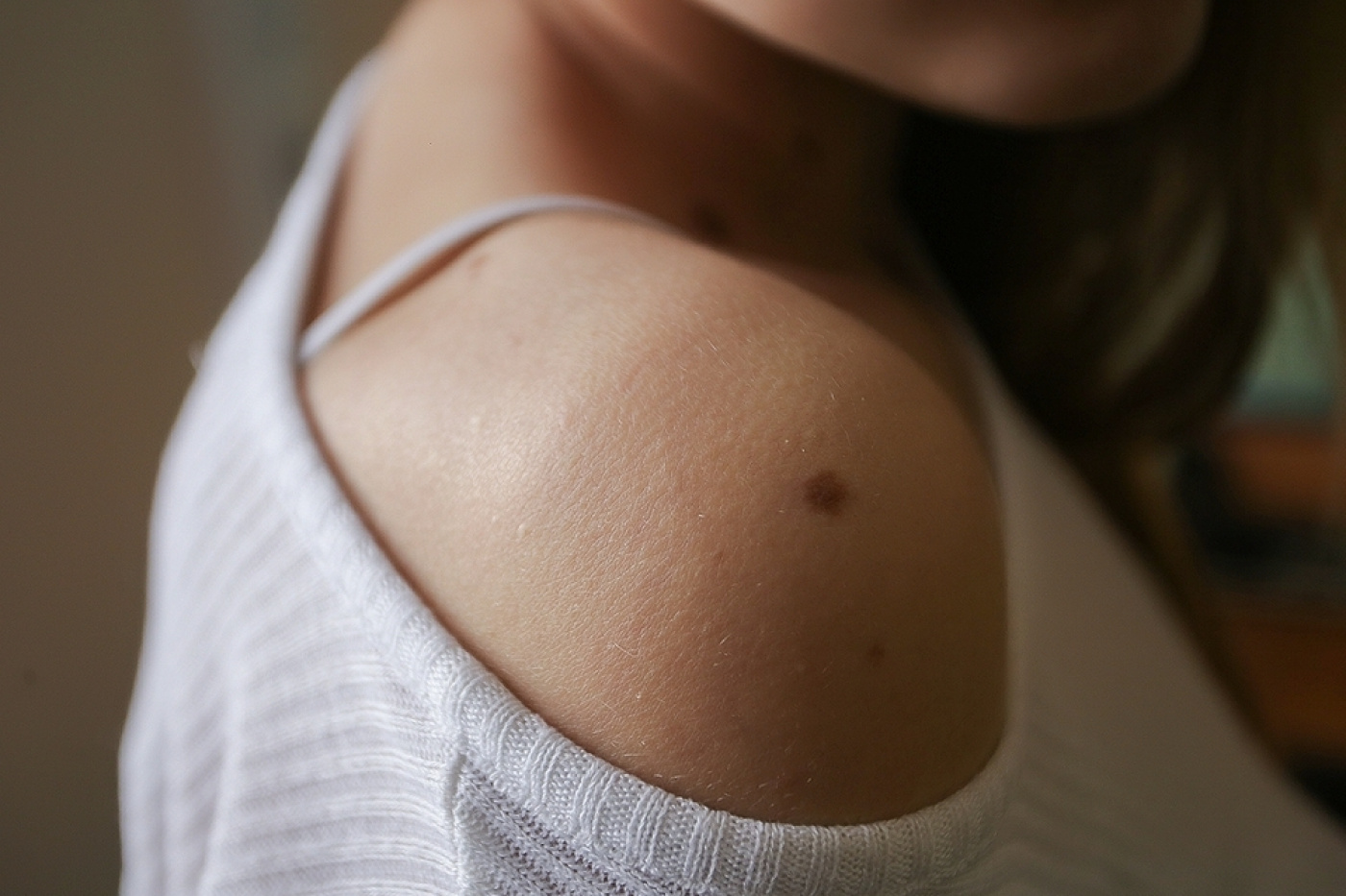 что означают родинки на груди у женщин фото 44